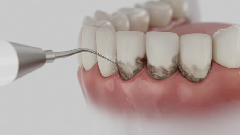 Reliable Dental Implants contractor in Whitefish Bay, WI by Smile Center Dentistry